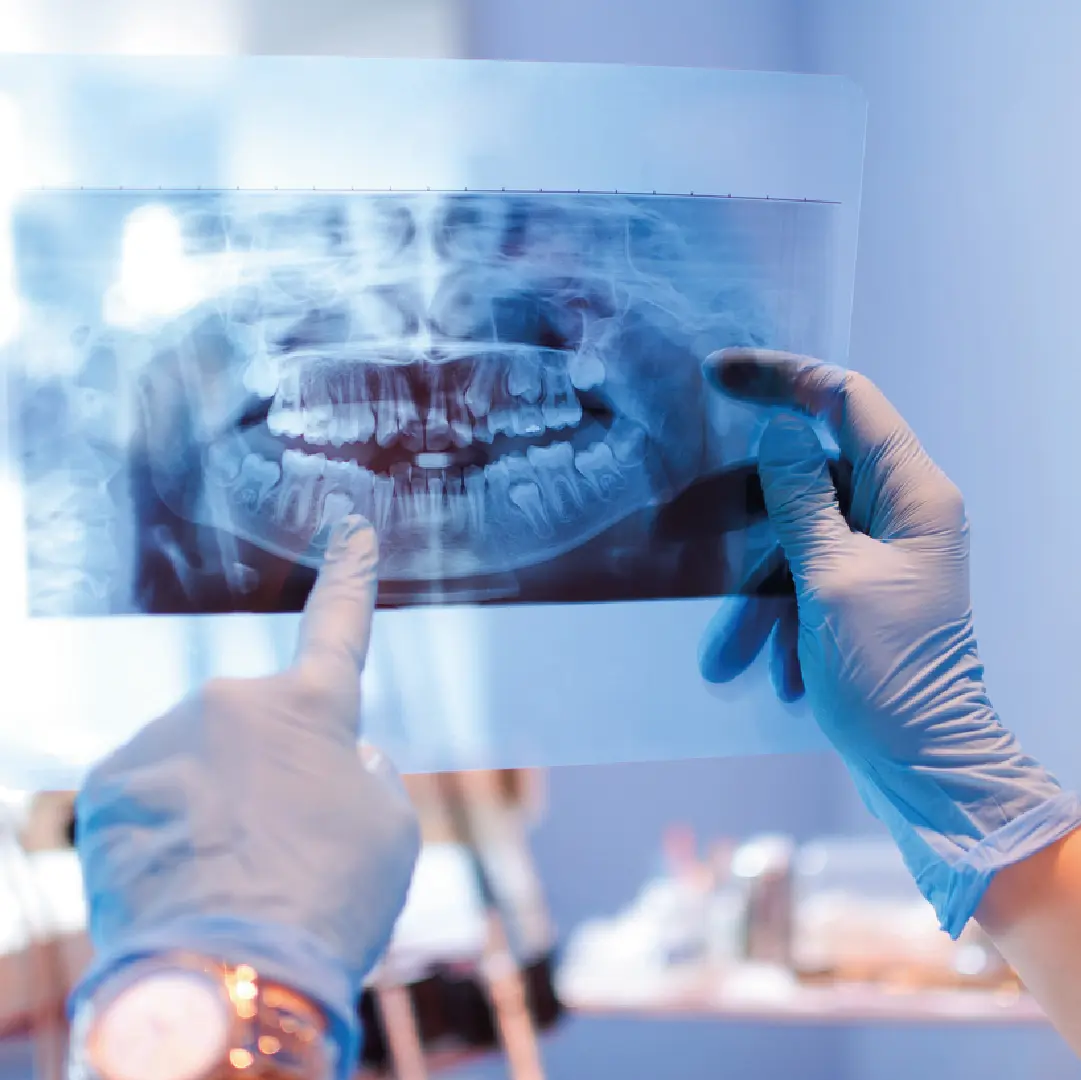 radiografia per a cirugia bucal santpedor