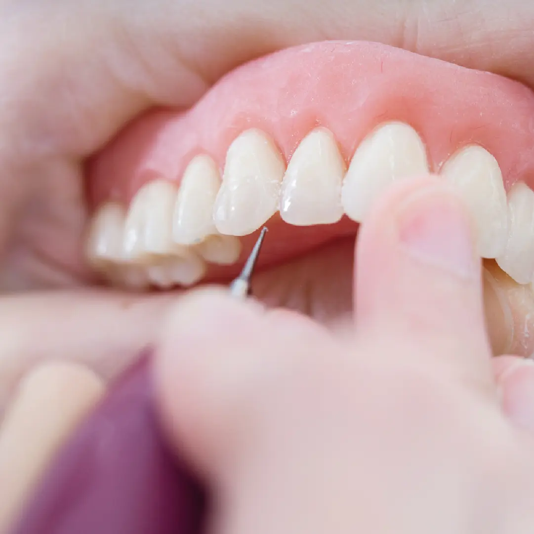 Pròtesi dental santpedor